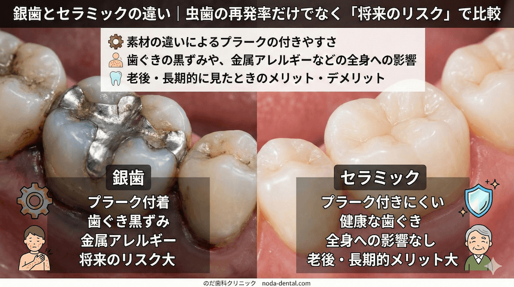 銀歯とセラミックの違い|虫歯の再発率だけでなく「将来のリスク」で比較