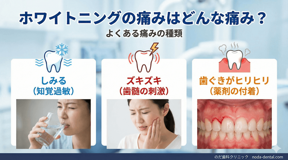 ホワイトニングの痛みはどんな痛み？
