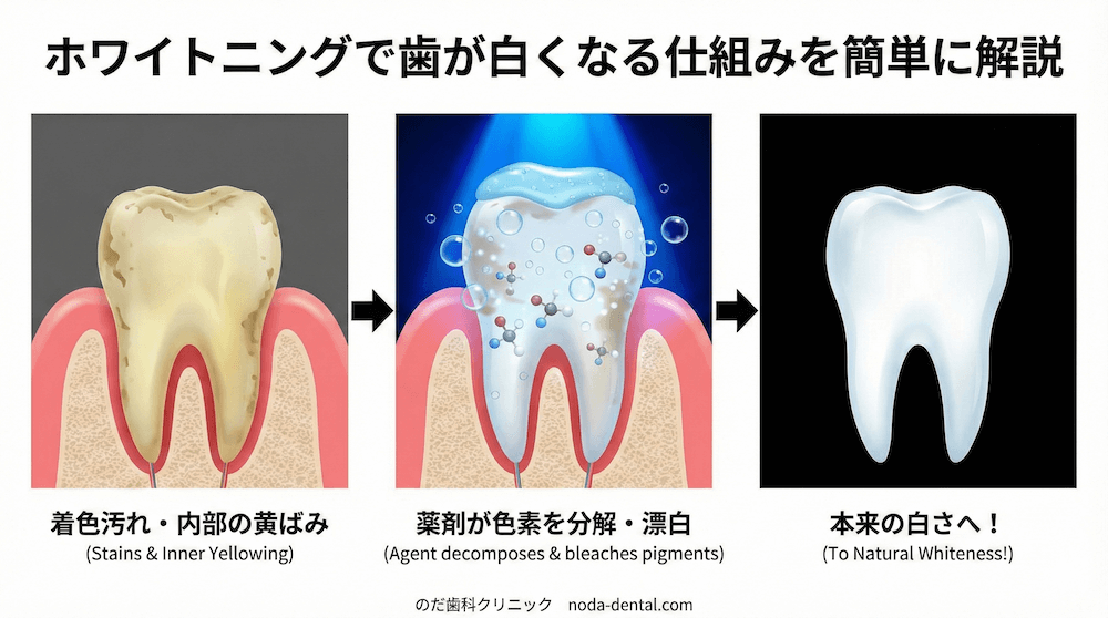 ホワイトニングで歯が白くなる仕組みを簡単に解説