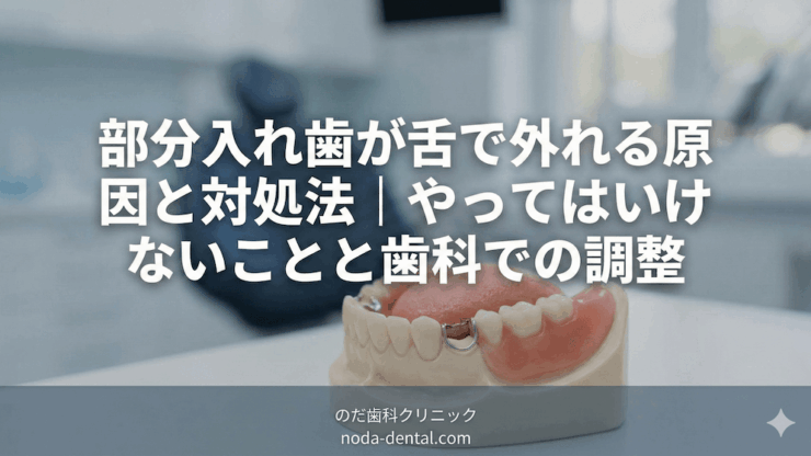 部分入れ歯が舌で外れる原因と対処法｜やってはいけないことと歯科での調整