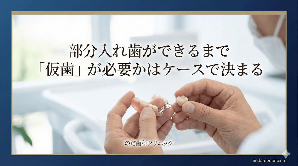 部分入れ歯ができるまで「仮歯」が必要かはケースで決まる
