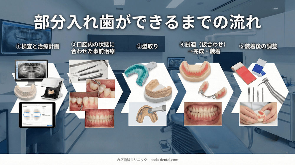 部分入れ歯ができるまでの流れ