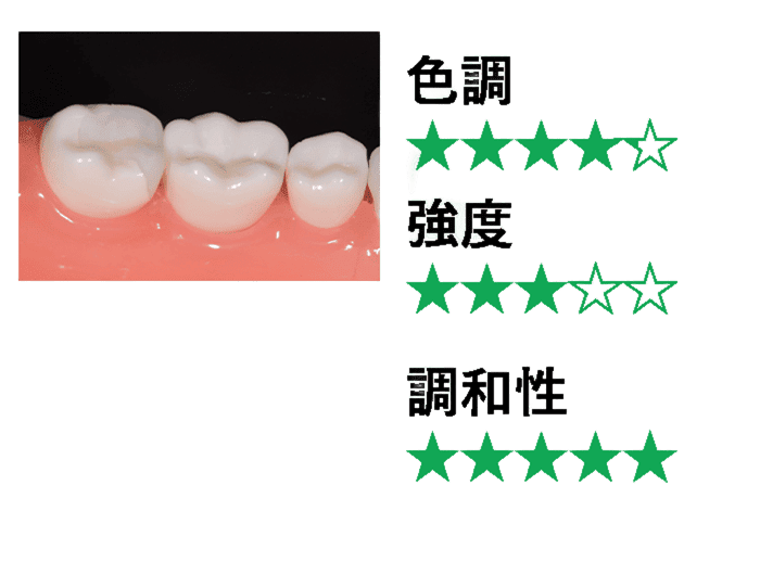 e-maxインレー