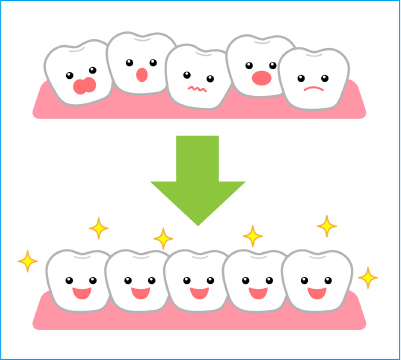 インビザラインで歯が移動する仕組み